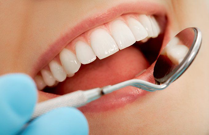 What You Should Know About Dental Insurance