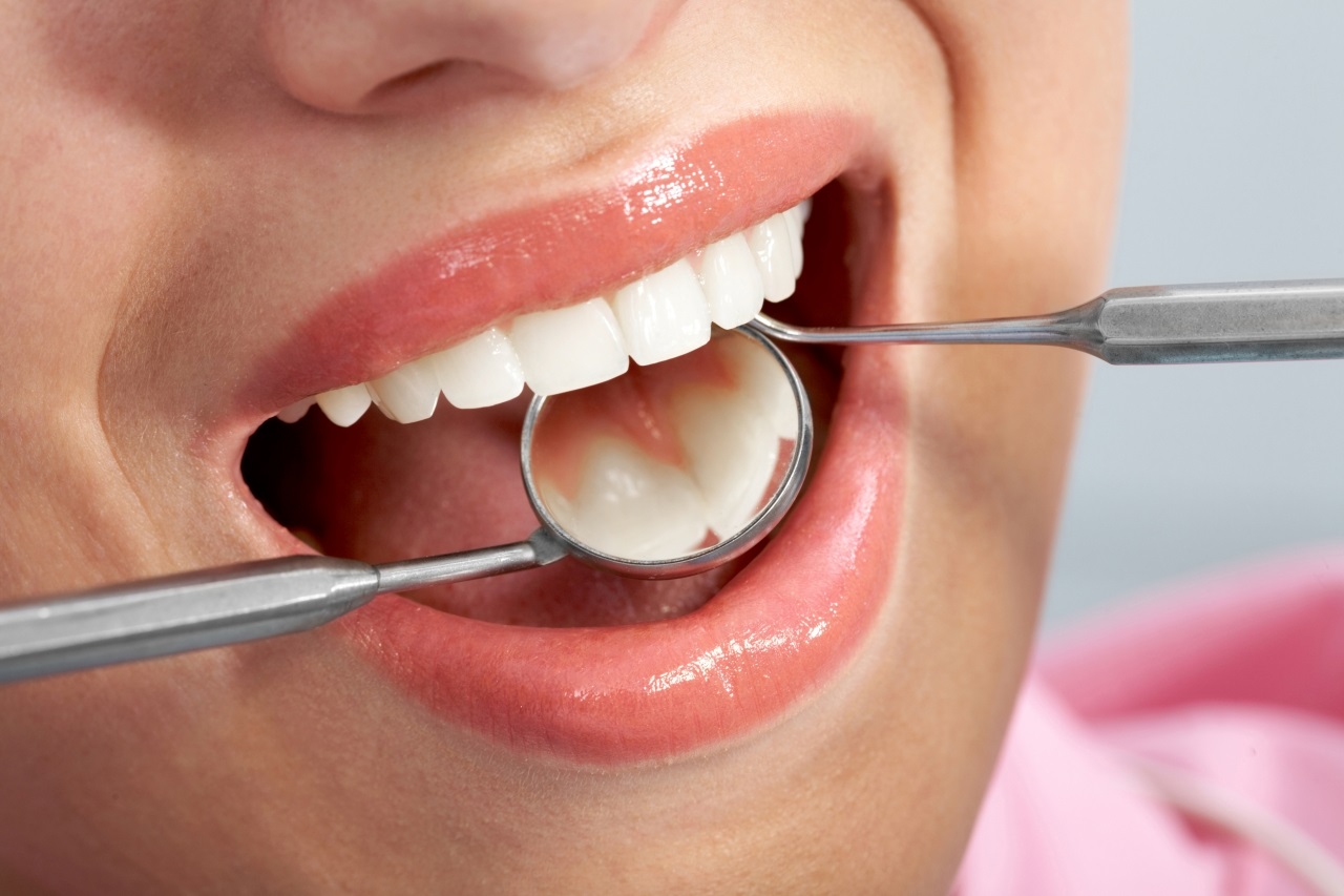 Composite Fillings Treats Dental Problems to Restore Your Smile