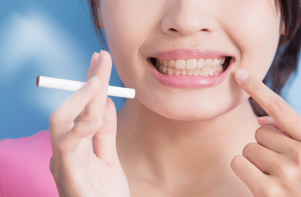 Impact of Cigarettes on Teeth- Your Sign to Quit Today!