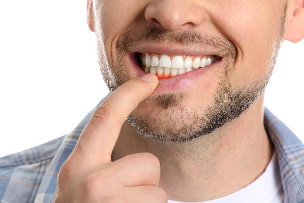 Expert Advice on Gum Disease Treatment in Dedham: The Benefits of Early Intervention