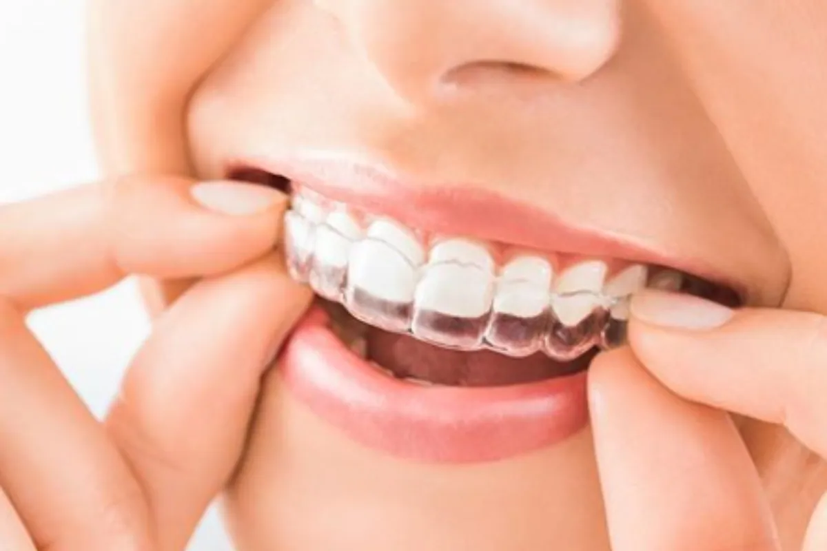 4 Simple Tips to Avoid Cavities
