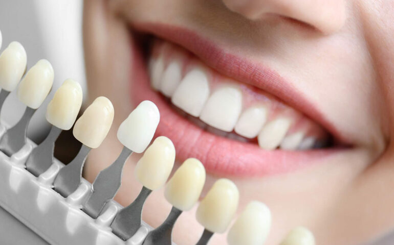 Cosmetic Dental Treatments That Can Make You Look Younger 