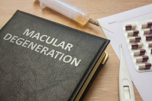 Macular Degeneration: Causes, Symptoms, and Treatment