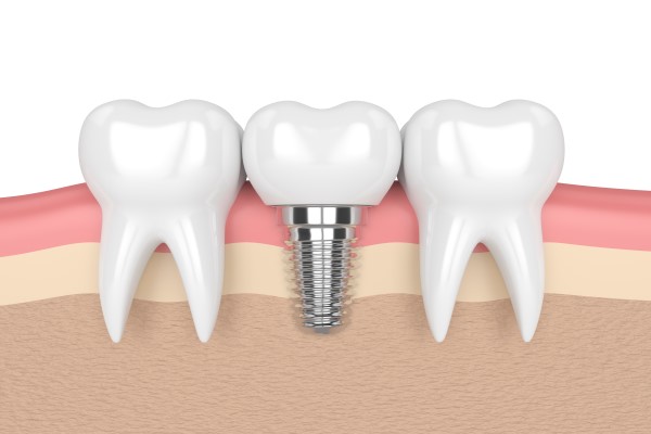 Pediatric Dental Procedures